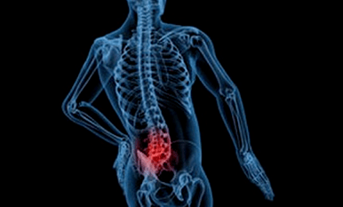 Le ragioni dello sviluppo dell'osteocondosi lombare