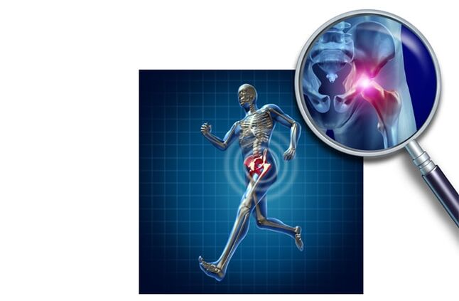 Dolore quando corri nell'articolazione dell'anca